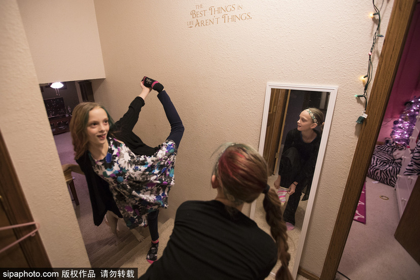 美國孿生連體姐妹分離手術后已茁壯成長11年