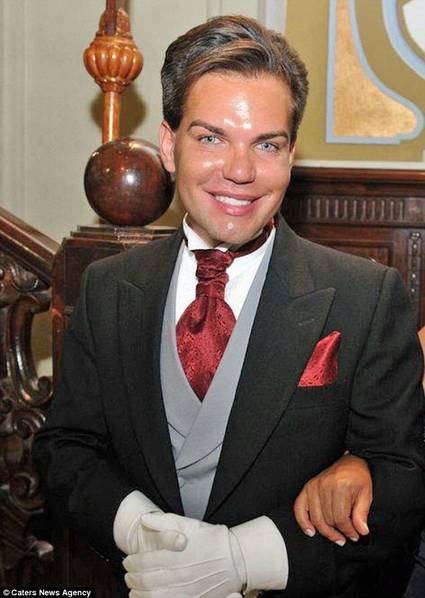 男子花300萬整容51次 破吉尼斯紀錄