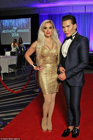 男子花300萬(wàn)整容51次 破吉尼斯紀(jì)錄