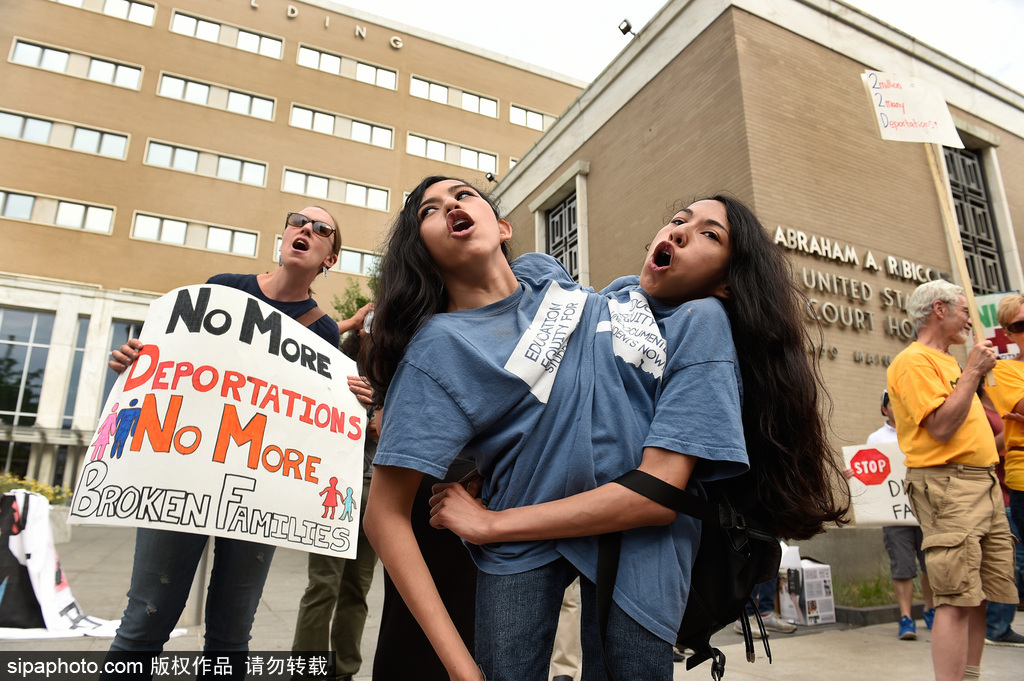 美國16歲連體姐妹拒做分離手術 她們的決定讓人無法理解