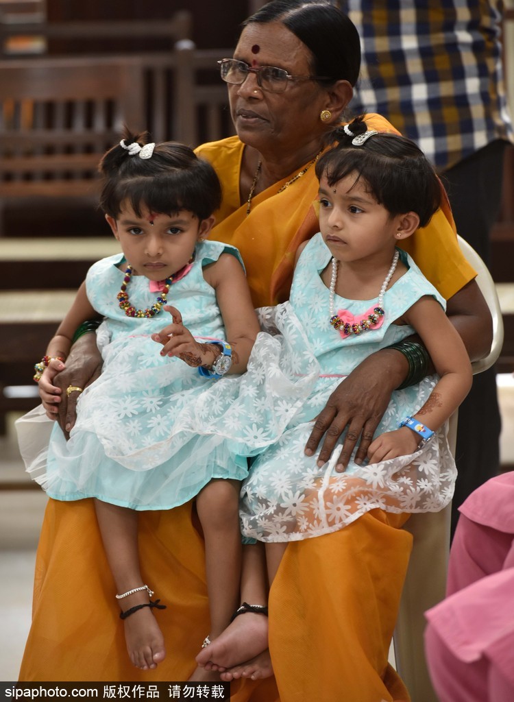 活下去就有希望 印度連體姐妹分離手術(shù)成功茁壯成長